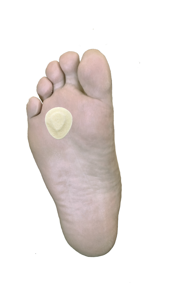 Metatarsal Neuroma Pad J-43