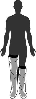 Cast Cover - with Neoprene Seal