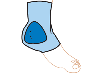 Gel Malleolar Sleeve