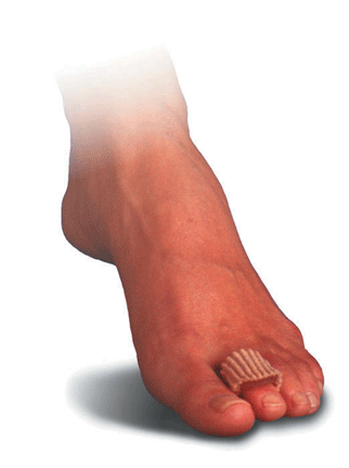 Toe Digital Corn Pads - Gel and Fabric