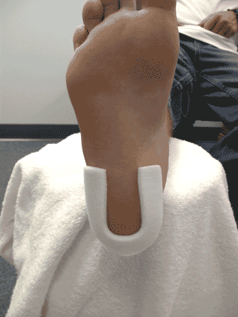 Heel (Spur) Pad J-21