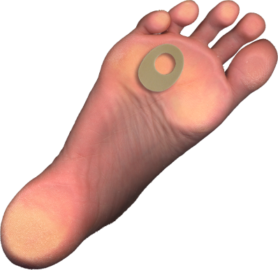 Callus Pad J-105