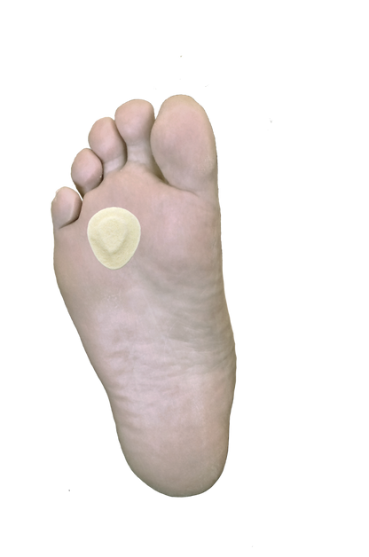 Metatarsal / Neuroma Pad J-43