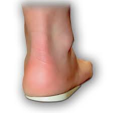 Warwick Heel Wedge