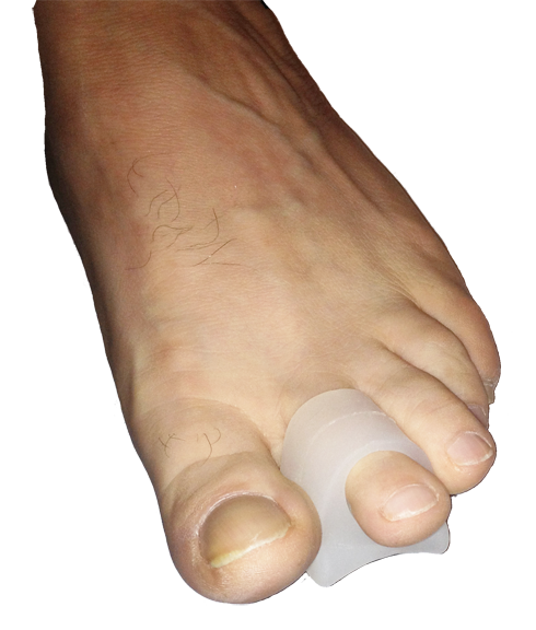 1 Toe Gel Crest pad - Patient Box -2 pads