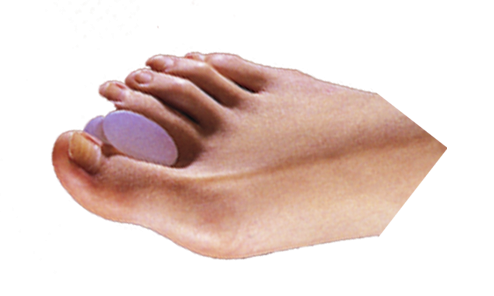 Toe Spreaders (Extra Wide Hourglass Gel Spreaders) (P-1 Hourglass)