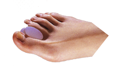 Toe Spreaders (Extra Wide Hourglass Gel Spreaders) (P-1 Hourglass)